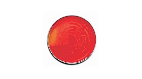 Prepared Microbiology Media