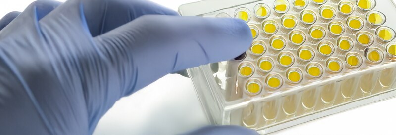 Multiserotype Enzyme-Linked Immunosorbent Assay using Microtiter Cliniplate